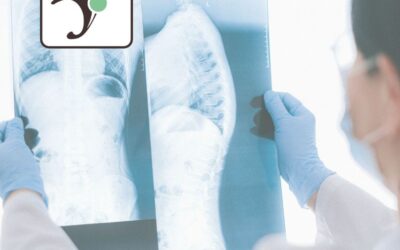 La radiographie : un examen clé pour le diagnostic des fractures
